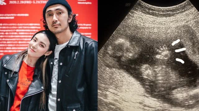 又一中国女星嫁日本人！官宣结婚入籍日本，晒B超照已怀孕5个月