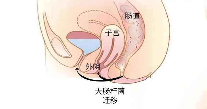 女性私处护理，绝不止勤换内裤那么简单