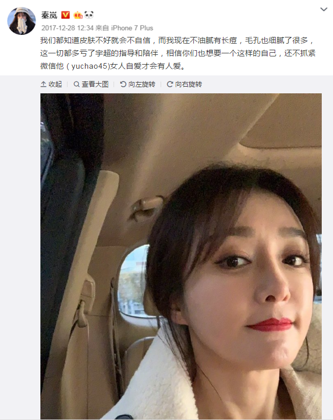 秦岚被嘲讽“脸垮掉”，为什么我们容不下一个真实的人